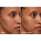 Hydrating Barrier Cream