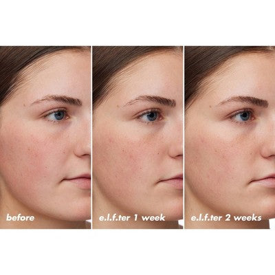 Hydrating Barrier Cream