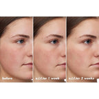 Hydrating Barrier Cream